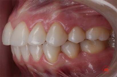 Image Alt Text